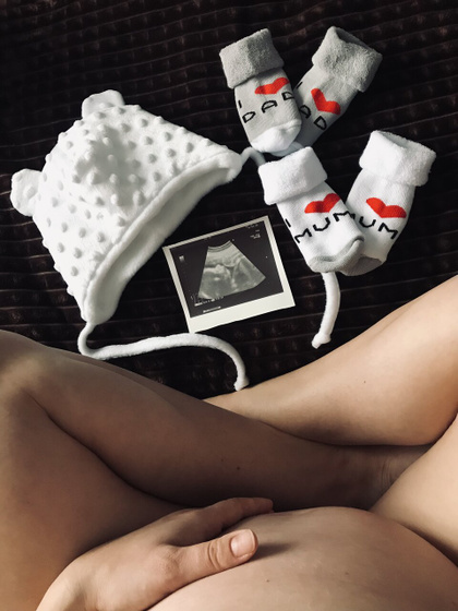 3 скрининг, 35 недель.