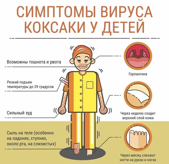 ВИРУС КОКСАКИ