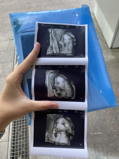 21 week