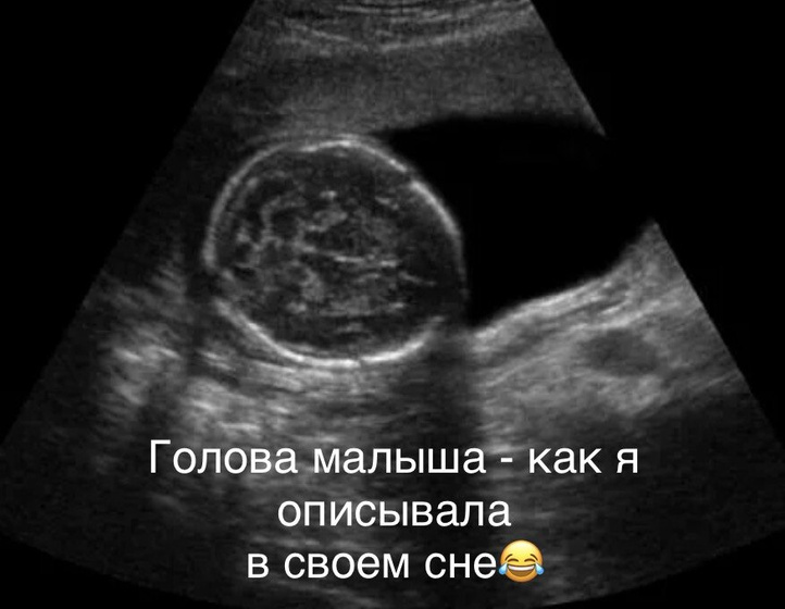 Сон на 10 дпо💤