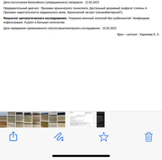 Фгдс с биопсией
