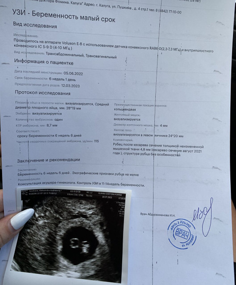 Беременна ?