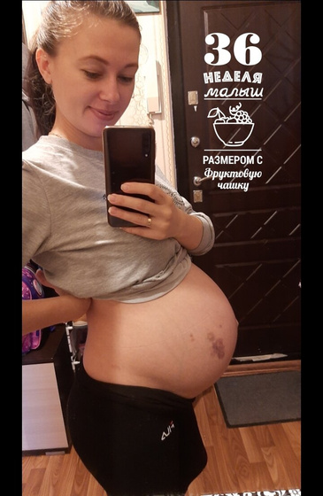 💗💗💗36 неделек💗💗💗
