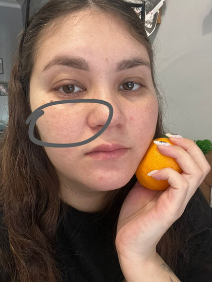 Это лицевой нерв болит?