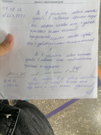 Сходили мы с переломом