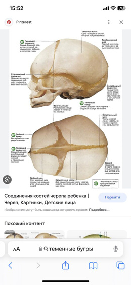 Теменные бугры