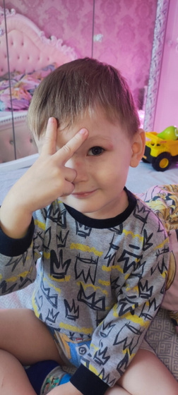 Не п°нос, так золотуха🤣 Прыщики у ребёнка (только на лице)