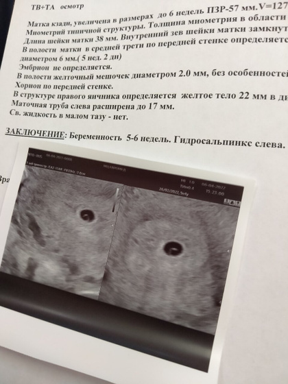 Я самая счастливая.?