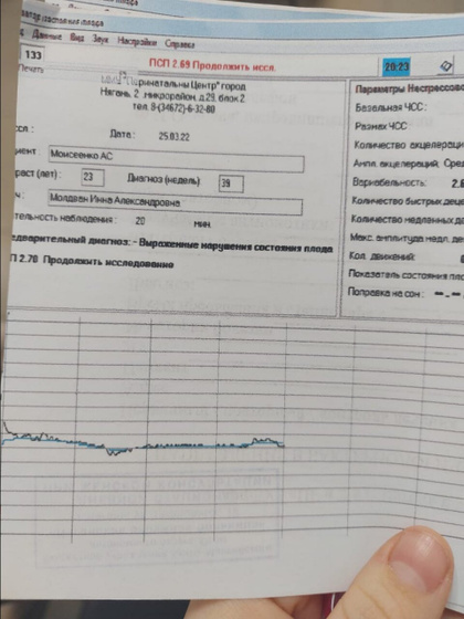 Вторая часть истории вторых