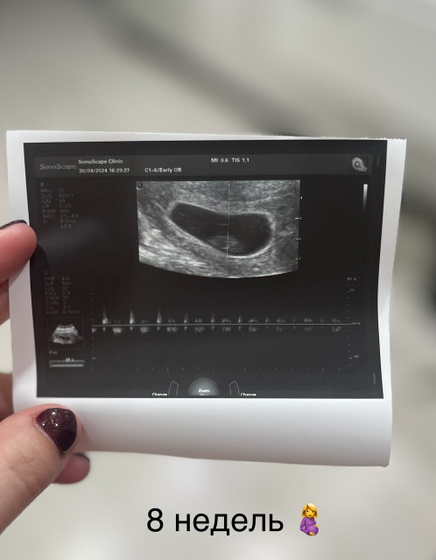 8 недель 🤰