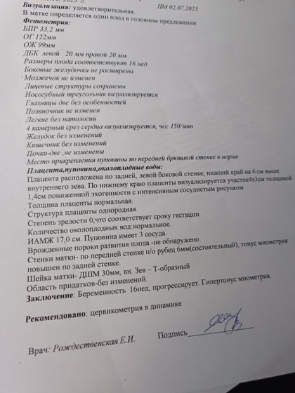 К пред посту про
