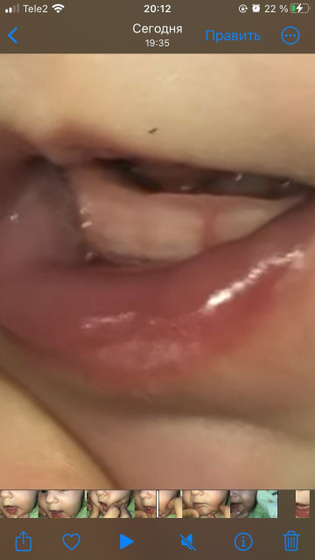 Зубы?
