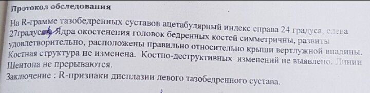 Дисплазия ТБС Подскажите что