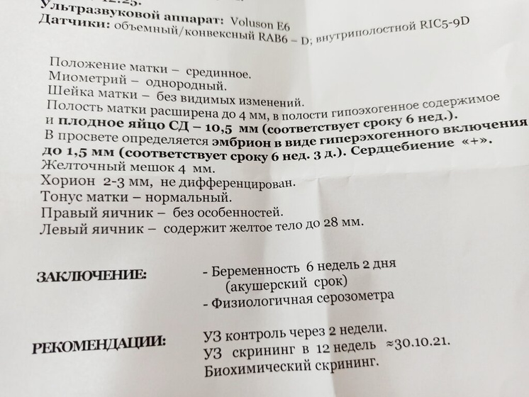 Первое УЗИ.