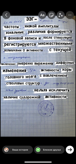 Расшифровка ЭЭГ