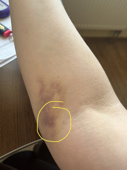 Неделю назад брали кровь,