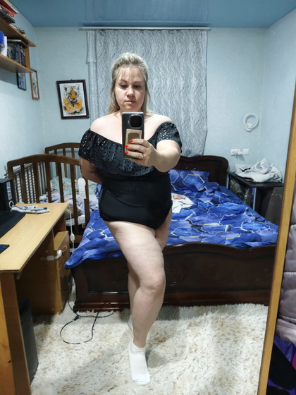 Абдоминопластика часть 2