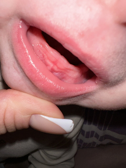 🦷 зубы ?