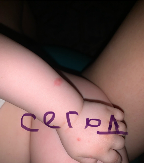 Срочно ! Тема укусов ! К пред посту !