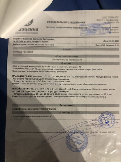Мой шок в шоке