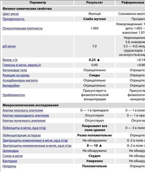 Плохой анализ мочи.