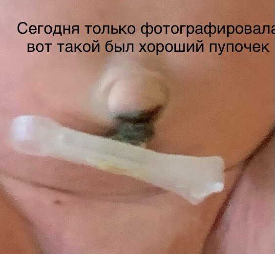 Пупок