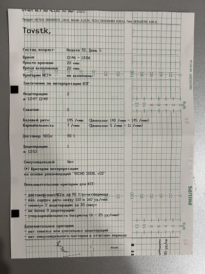 КТГ