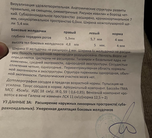 Узи головы ?
