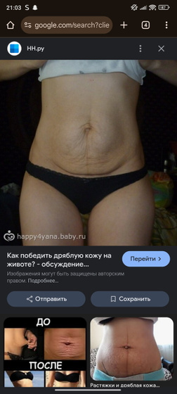 Купальник