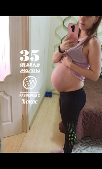 Уже и 35 недель🤰💙