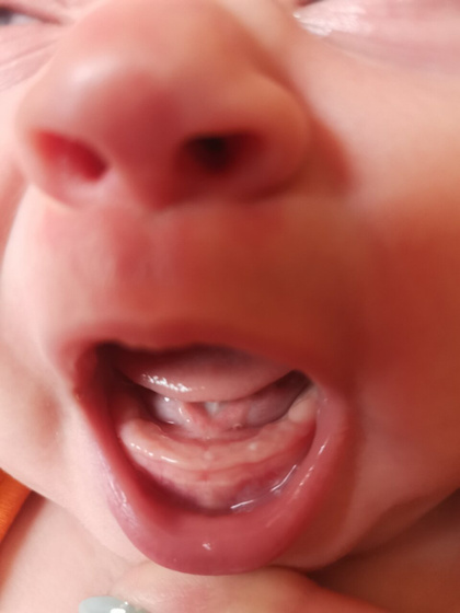 Зубы