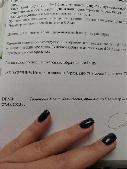 Просто нет слов....