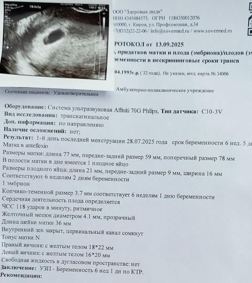 Ну вот и я сходила на 1 УЗИ.