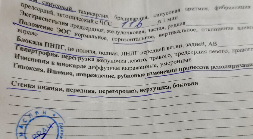 Плохое ЭКГ