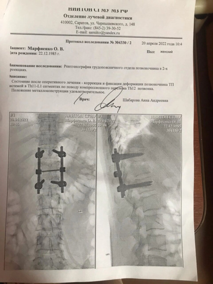 Перелом позвоночника