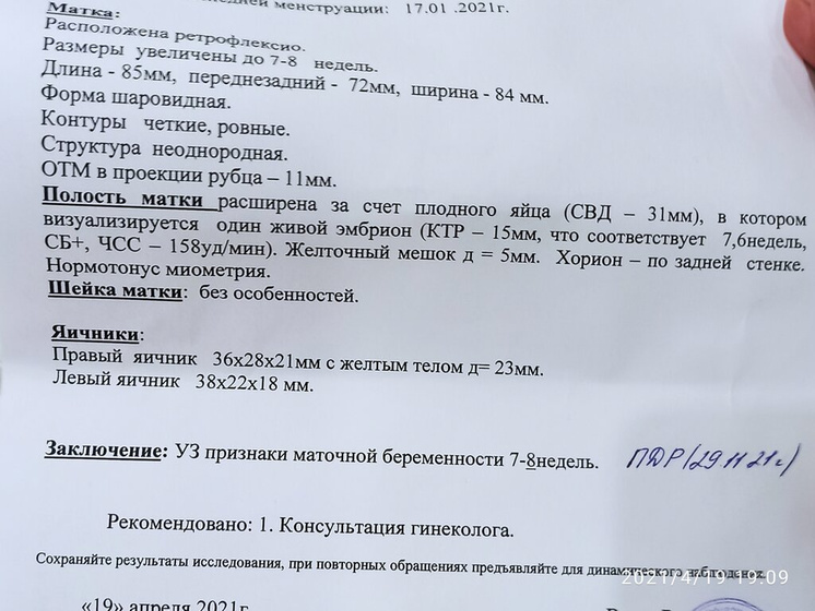 Сделала УЗИ