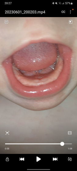 Зубки