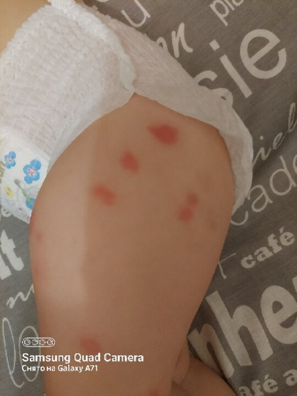 Что может быть за