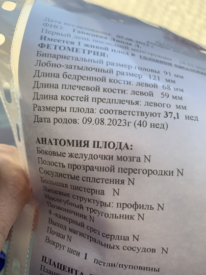пдр