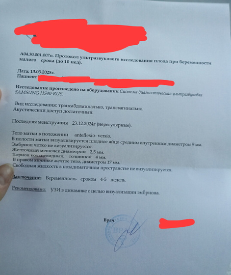 Узи