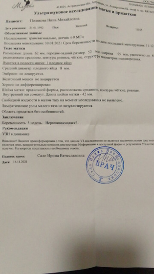 Зб или что?