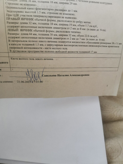 Киста яичника