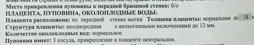 УЗИ