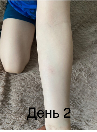 Итоги по диаскину .