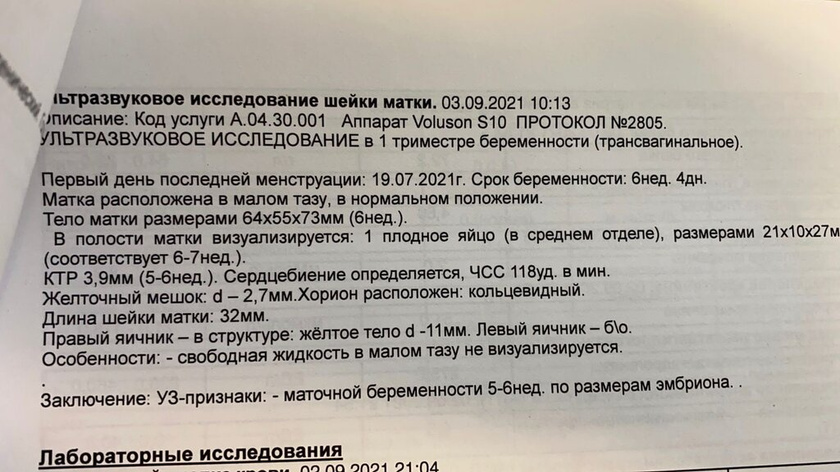 Узи не мое