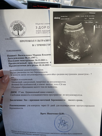 Сходила на узи!