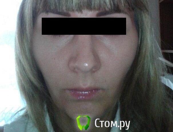Хочу брекеты очень ,