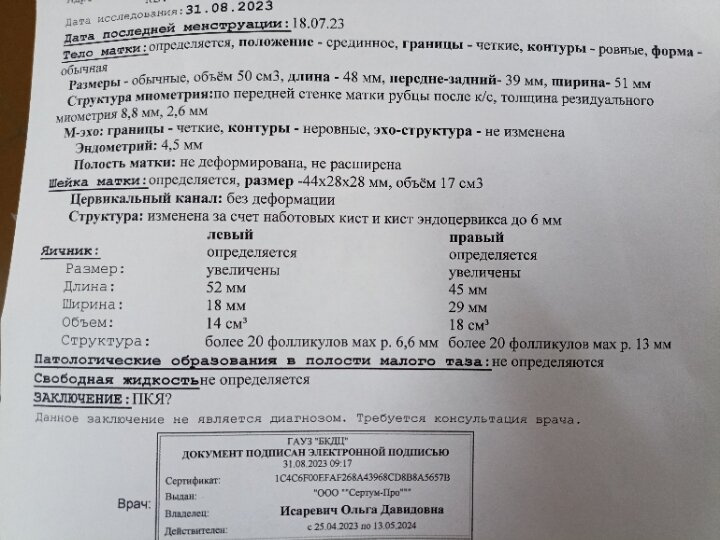 Узи