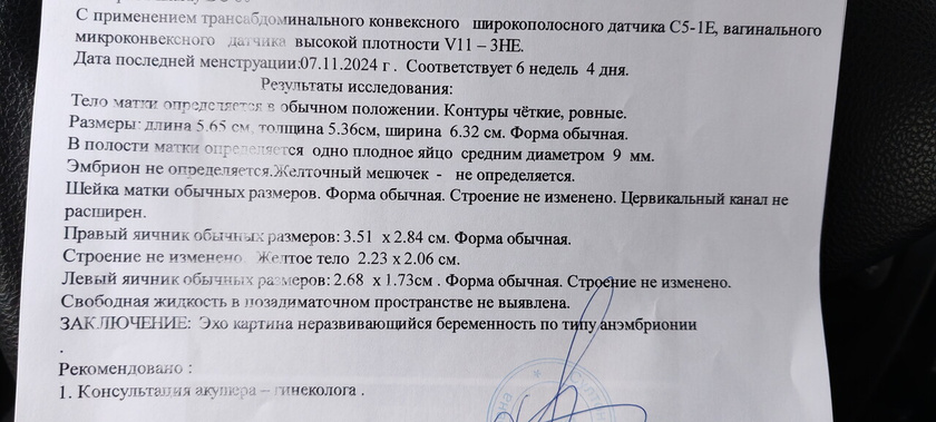 Сделала повторное узи