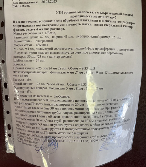 Результаты УЗГСС